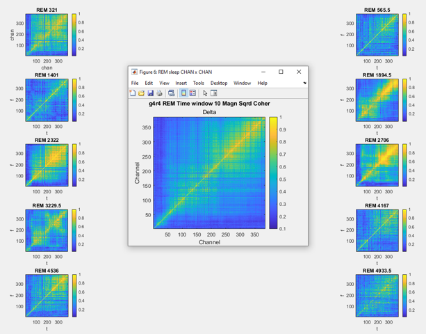 Squared coherence across channels during REM sleeping stages