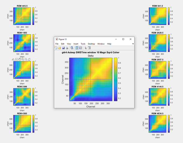 Squared coherence across channels during SWS sleeping stages